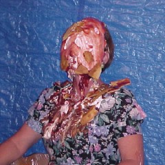 electroshock: 