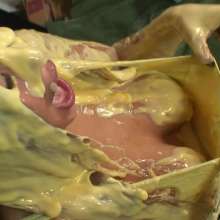MissT: Custard Beth
