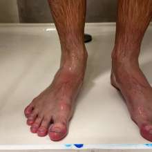 NynoGunge: Playing with Blue Painted Feet
