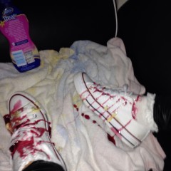 jamcustard22: Brand new converses ruined.